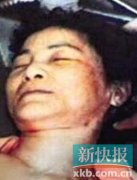 ����������������� ʬ�����ع���������(ͼ)